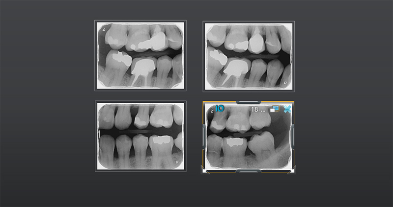 bw bilateral 01