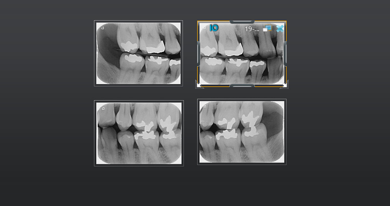 bw bilateral 02