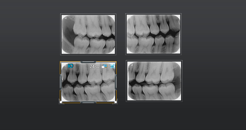 bw bilateral 05