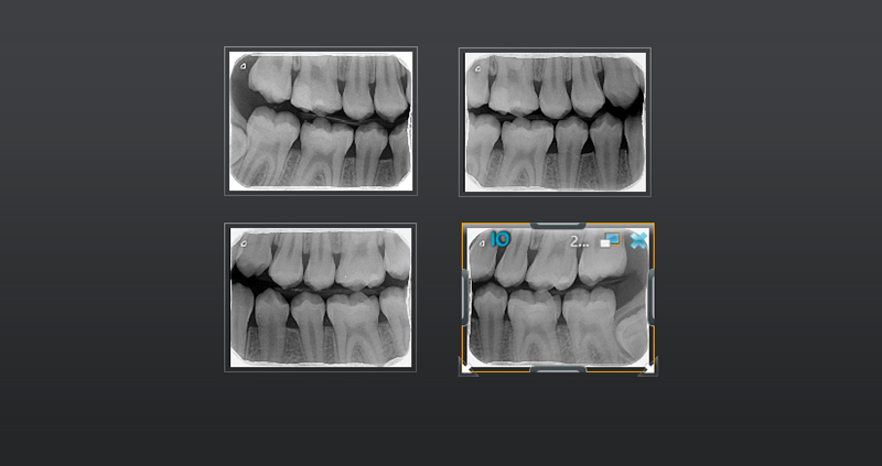 bw bilateral 06