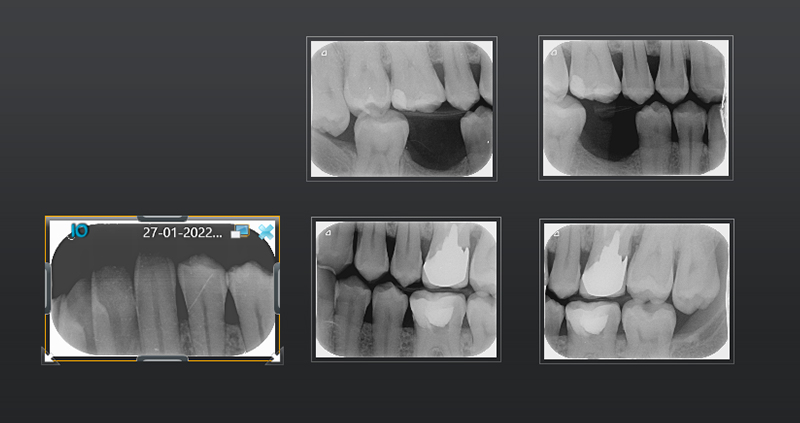 bw bilateral 08