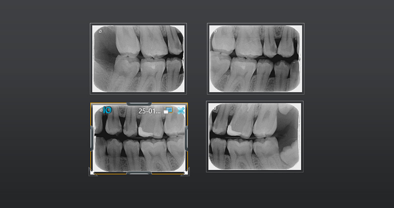 bw bilateral 09