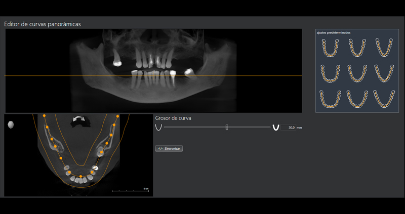 cbct bimax 01