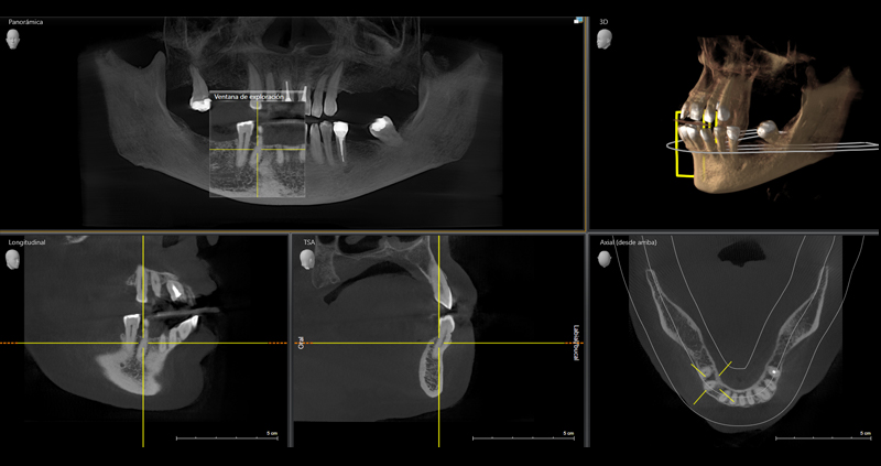 cbct bimax 04