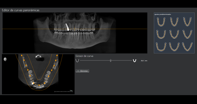 cbct bimax 07