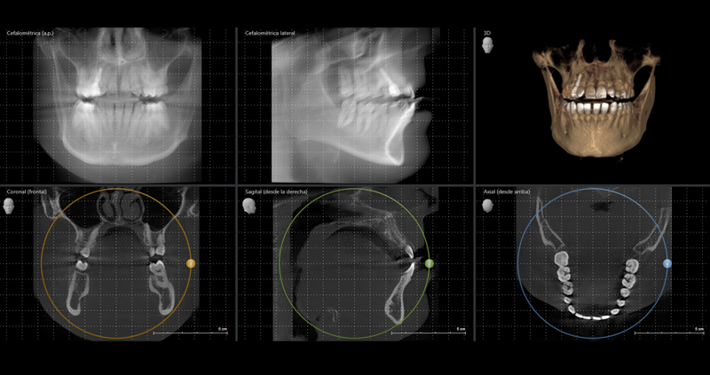 cbct bimax 08