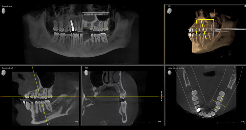 cbct bimax 10