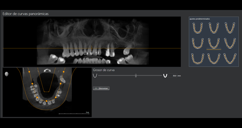 cbct max 01