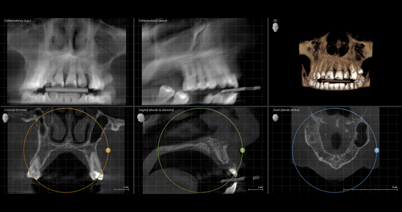 cbct max 02