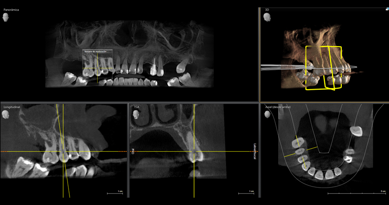 cbct max 03