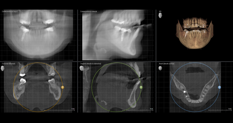 cbct max 05