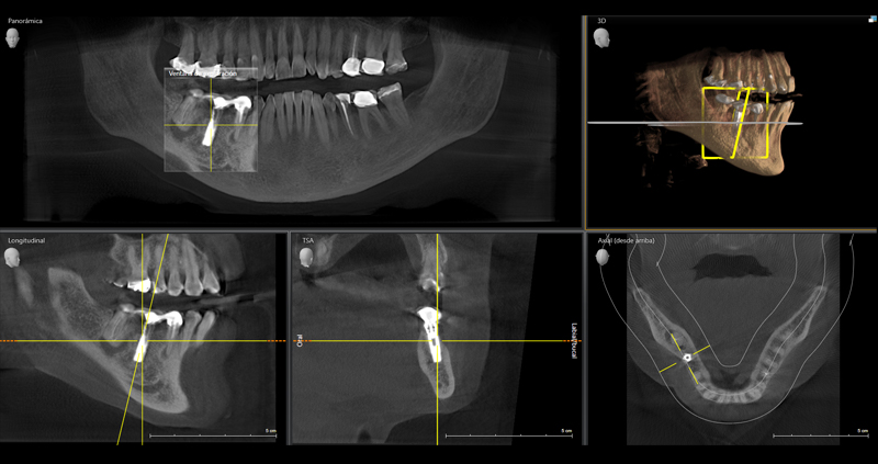 cbct max 06