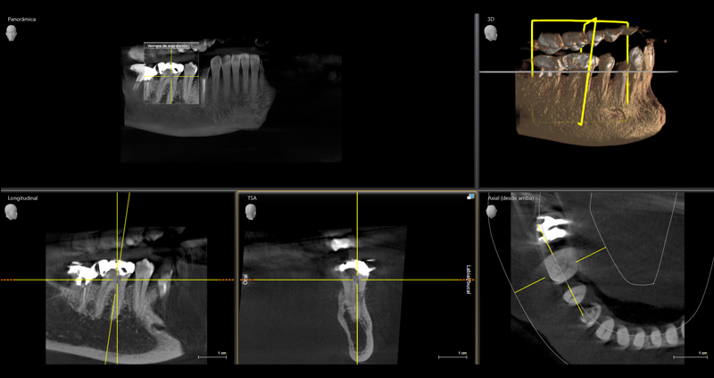 cbct zona 01