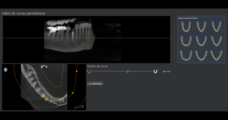 cbct zona 02