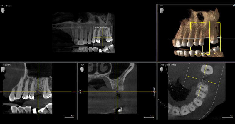 cbct zona 03