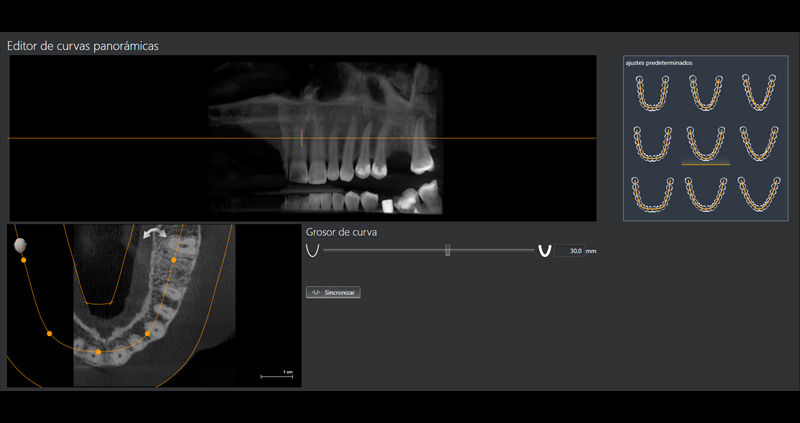 cbct zona 04