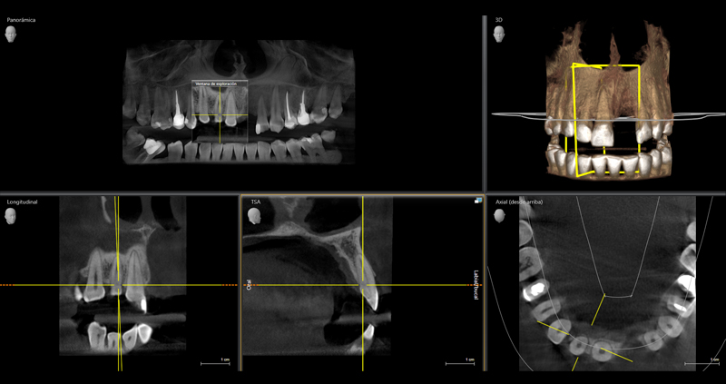 cbct zona 06