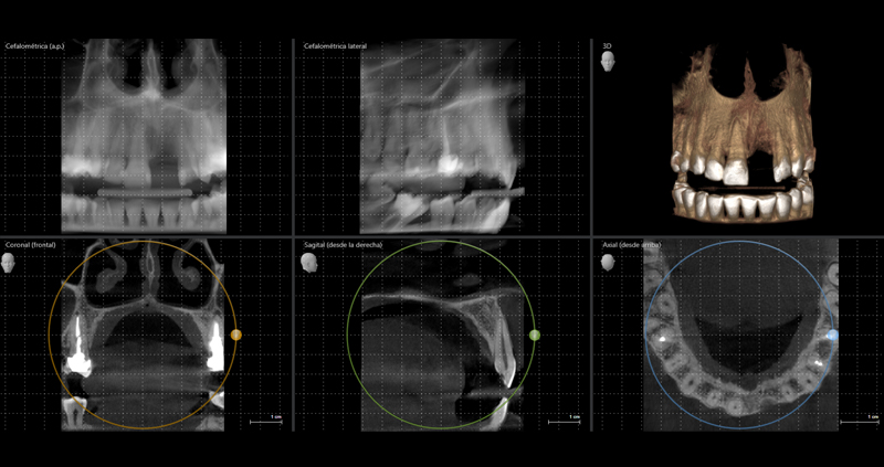 cbct zona 07