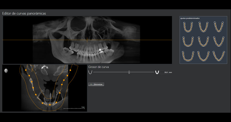 cbct atm bc 01