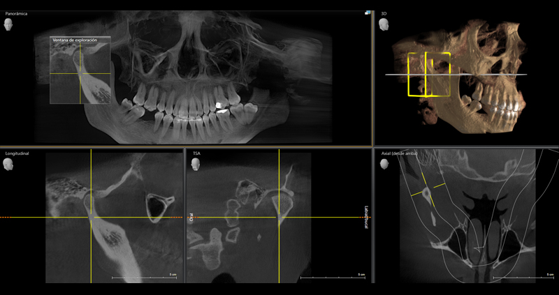 cbct atm bc 03