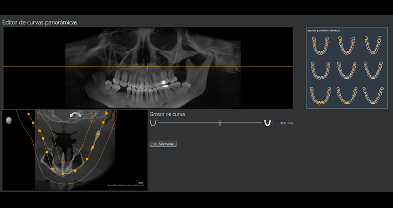 cbct atm bc 04