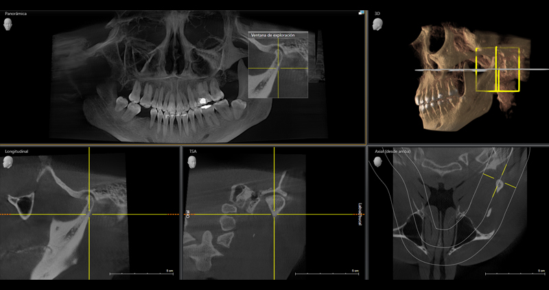 cbct atm bc 06